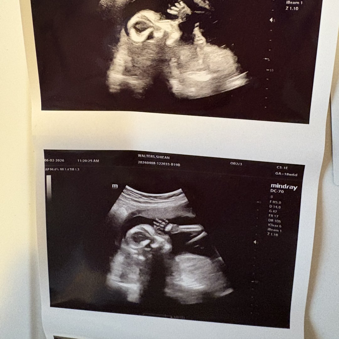 Photo shared by Shiean for their Babylist baby registry.