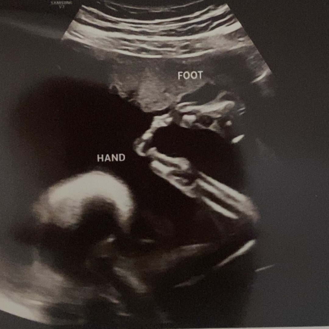 Photo shared by Maria for their Babylist baby registry.