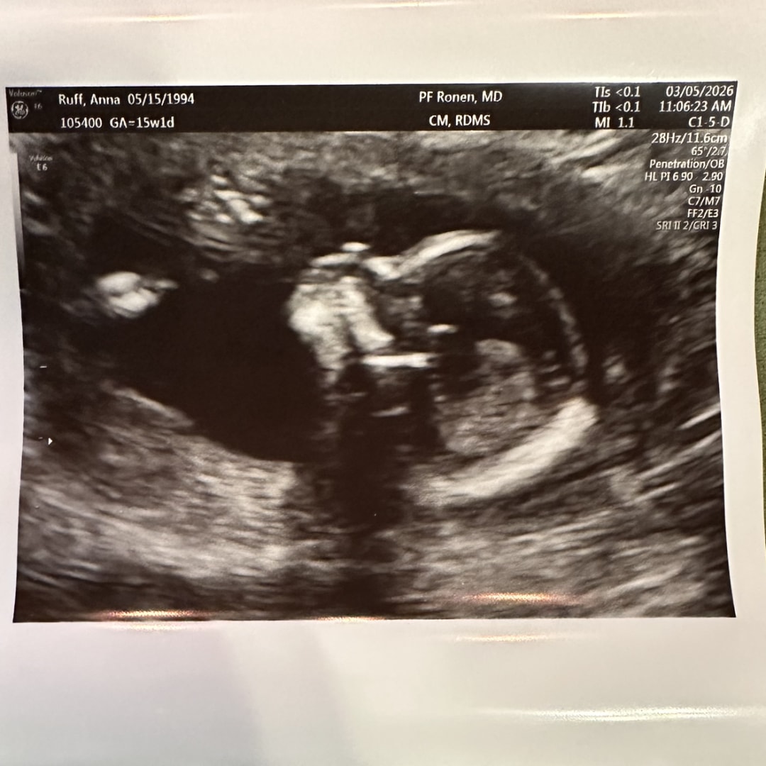 Photo shared by Anna for their Babylist baby registry.
