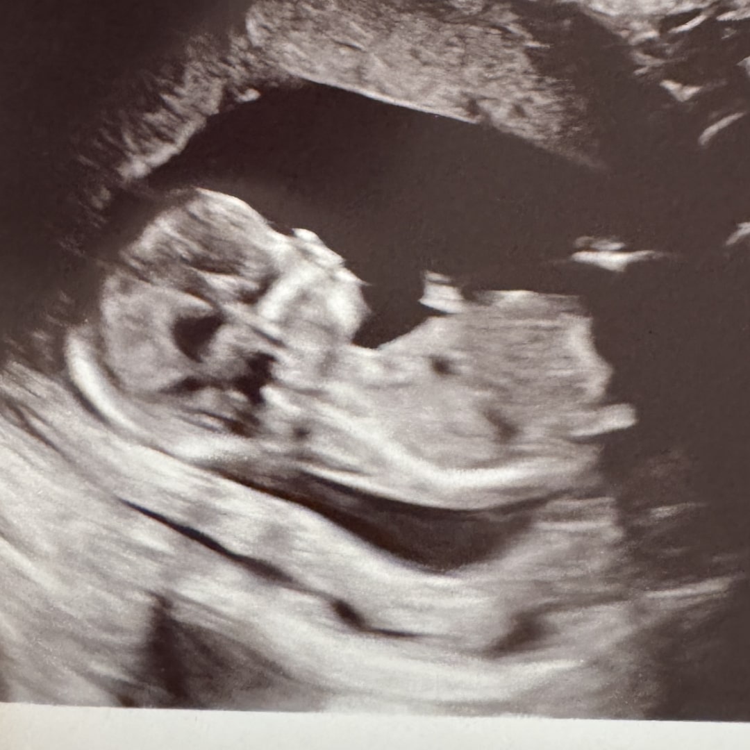 Photo shared by Juliana for their Babylist baby registry.