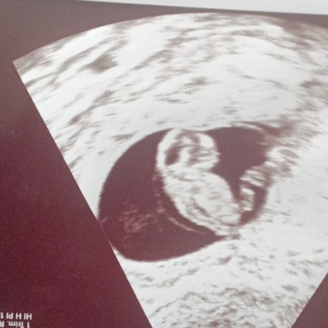 Photo shared by Tara for their Babylist baby registry.