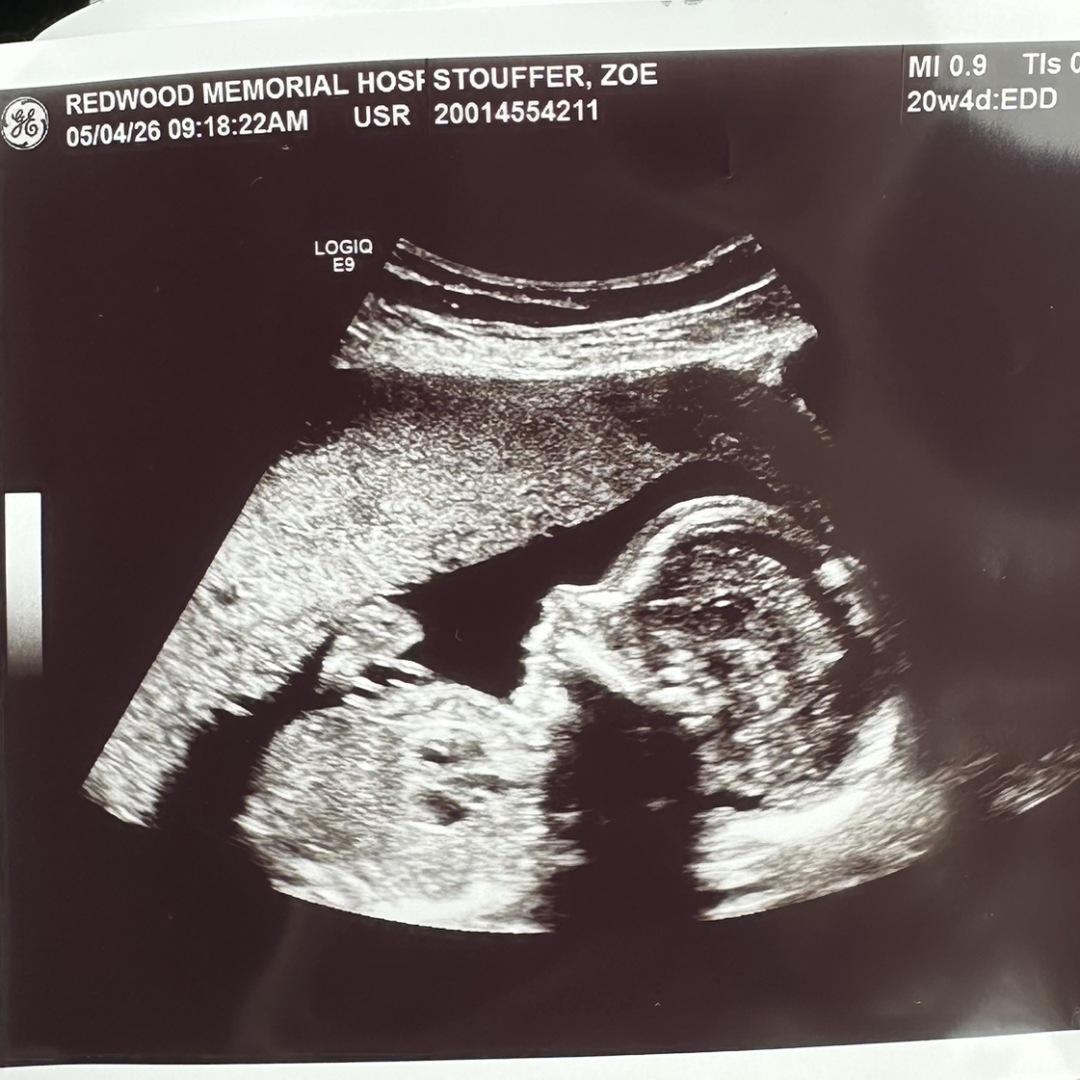 Photo shared by Zoe for their Babylist baby registry.