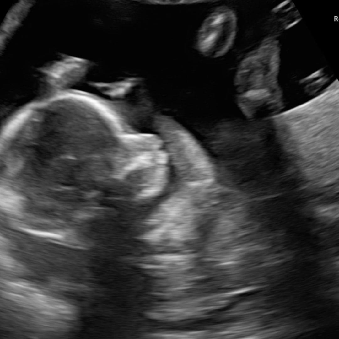 Photo shared by Erica for their Babylist baby registry.