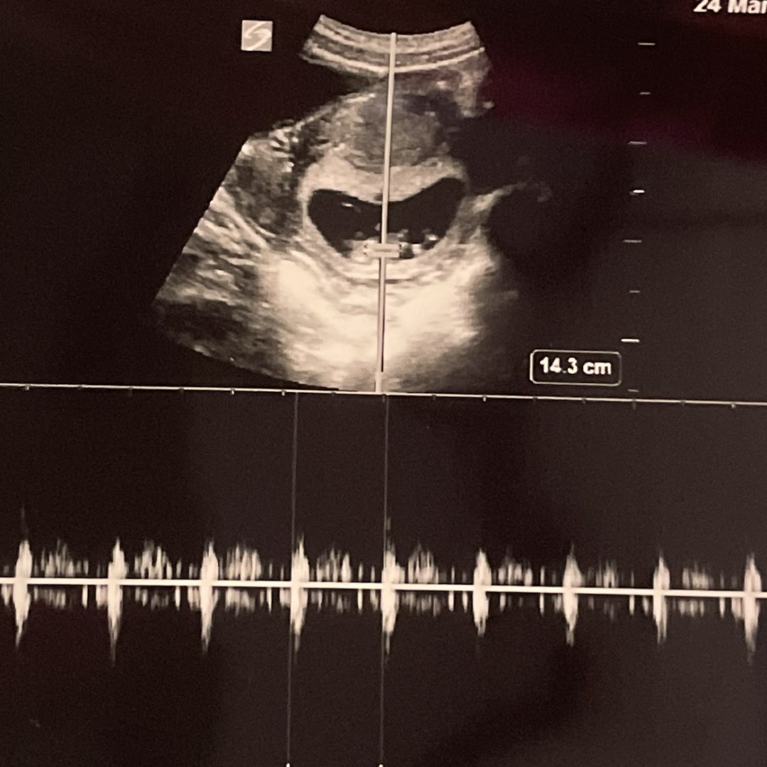 Photo shared by Alexi for their Babylist baby registry.