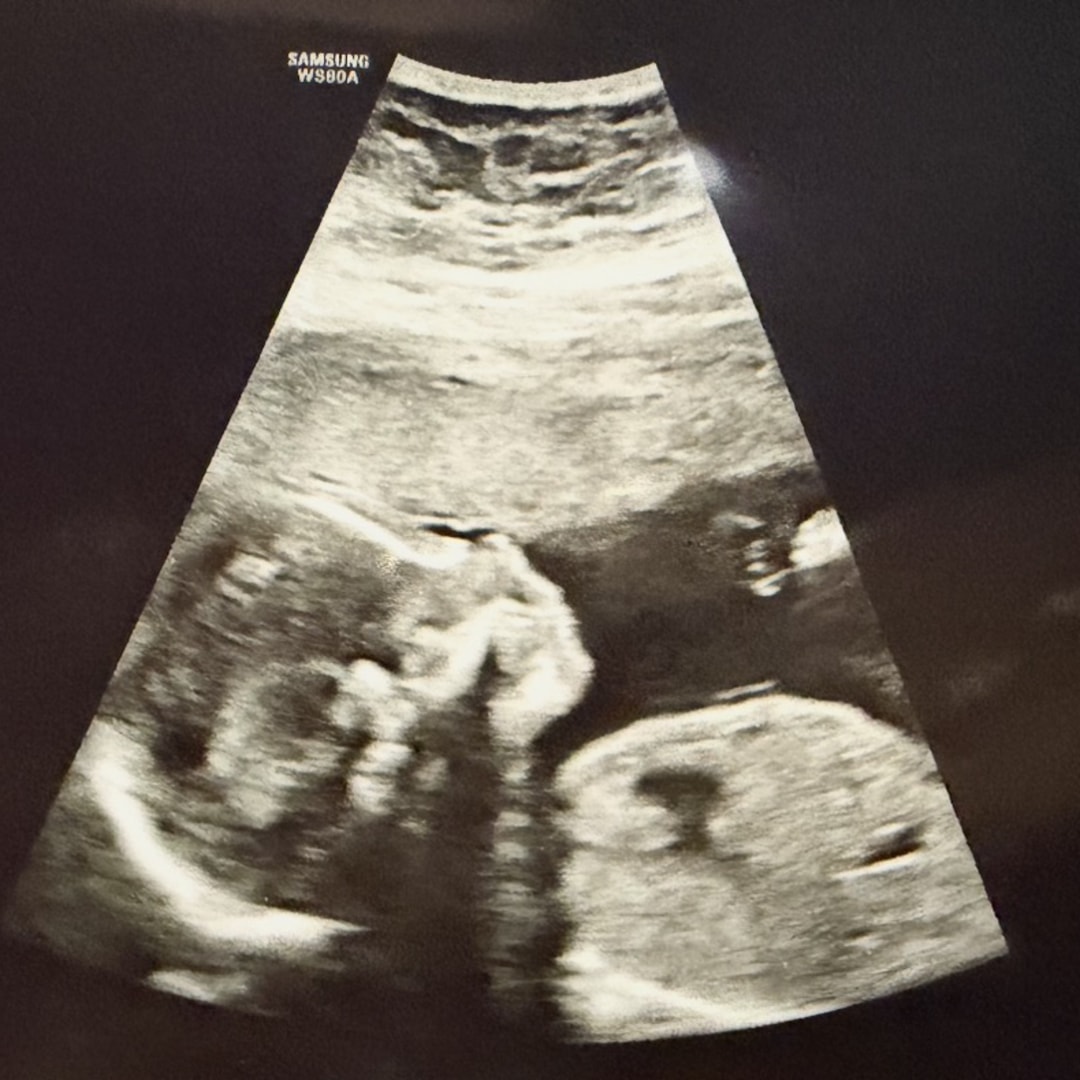Photo shared by Sarah for their Babylist baby registry.