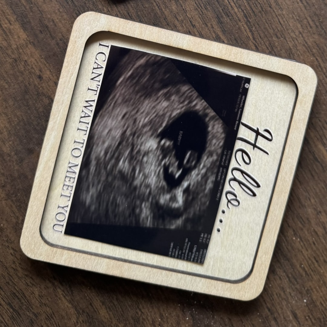 Photo shared by Summer for their Babylist baby registry.