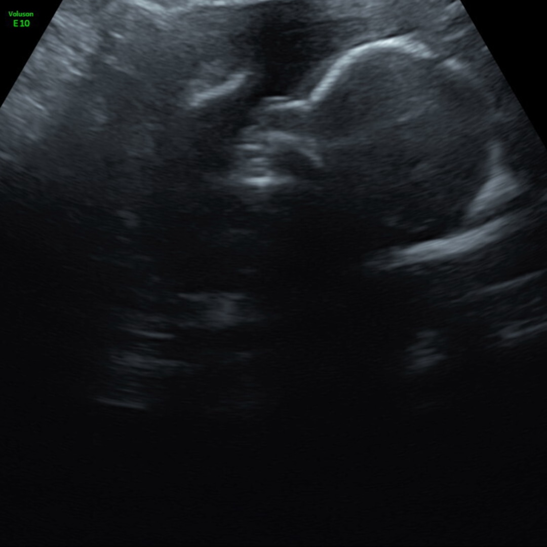 Photo shared by Kiana for their Babylist baby registry.