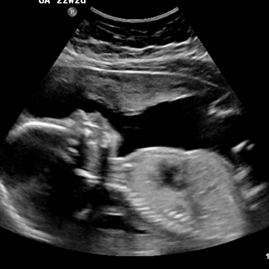 Photo shared by Kemari for their Babylist baby registry.