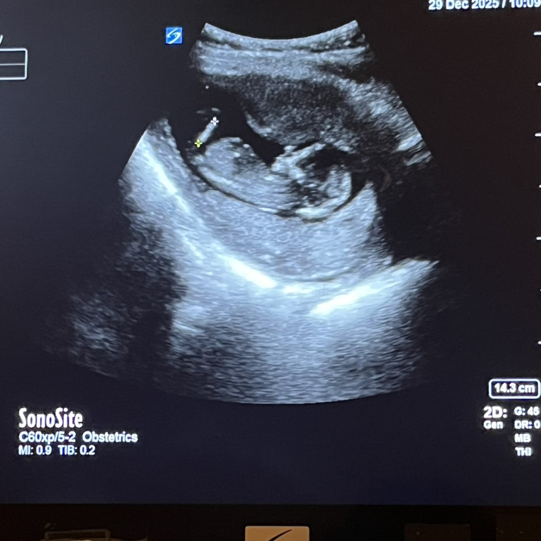 Photo shared by Candice Autumn for their Babylist baby registry.