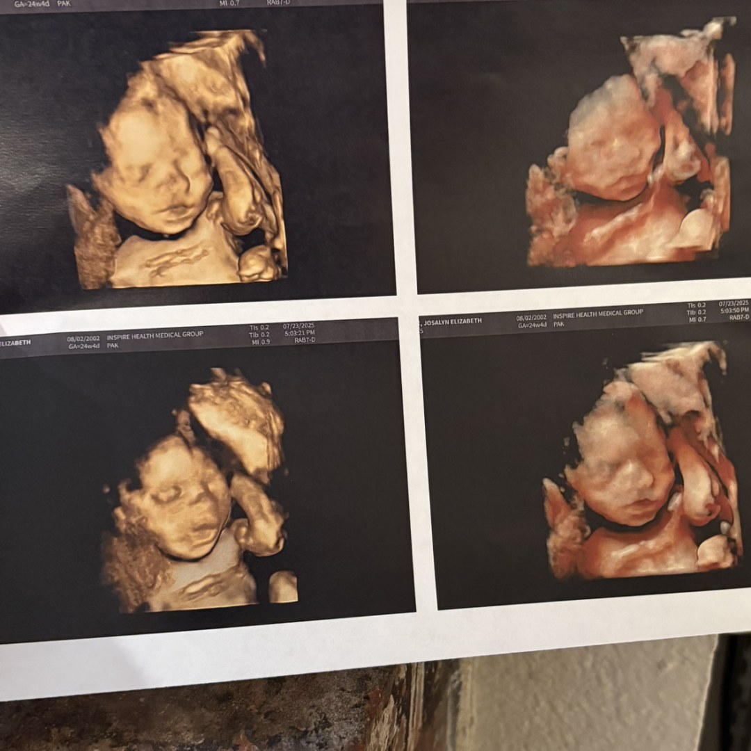 Photo shared by Josalyn for their Babylist baby registry.