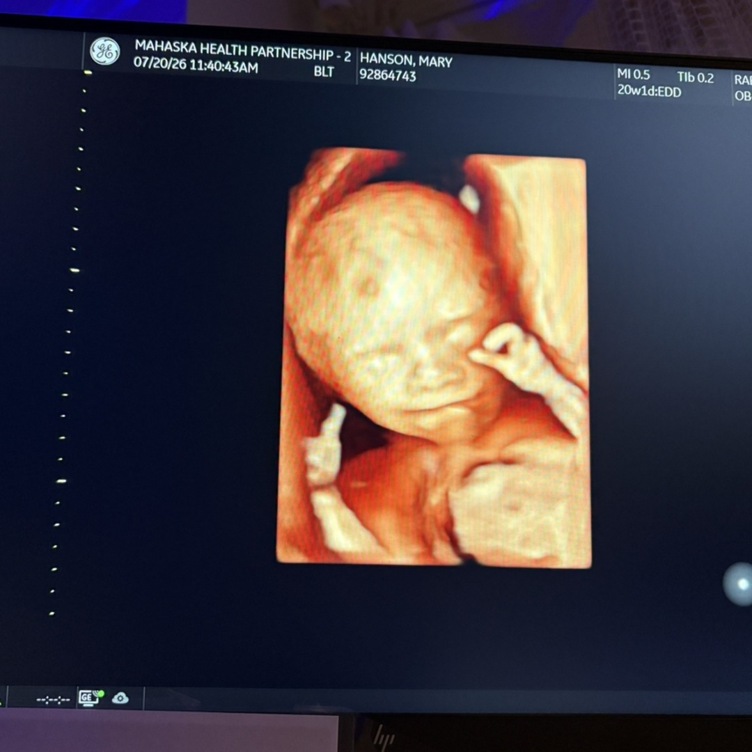 Photo shared by Mary for their Babylist baby registry.