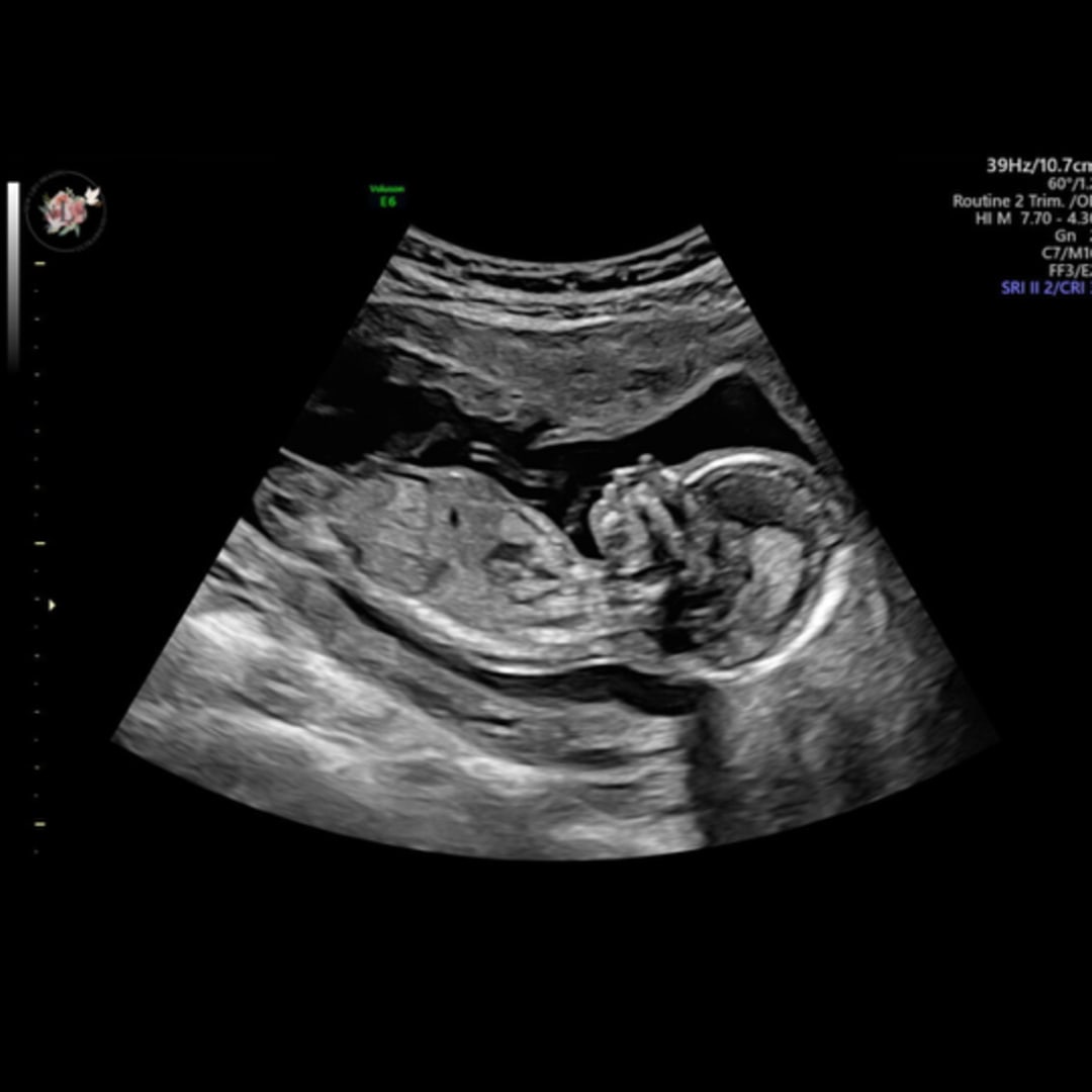 Photo shared by Savanna for their Babylist baby registry.