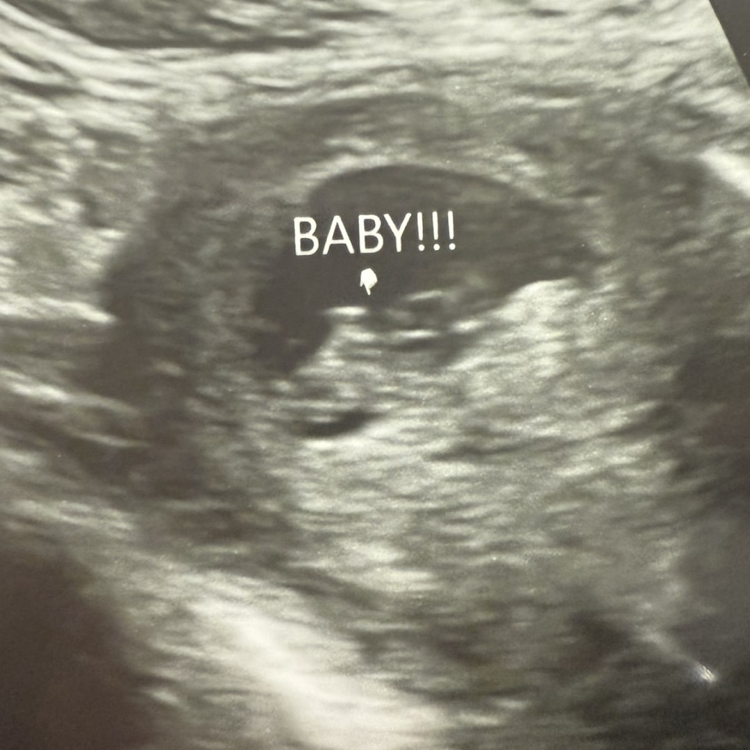 Photo shared by Sarah for their Babylist baby registry.