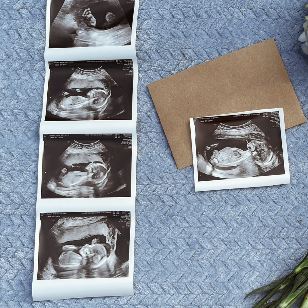 Photo shared by Rachel for their Babylist baby registry.