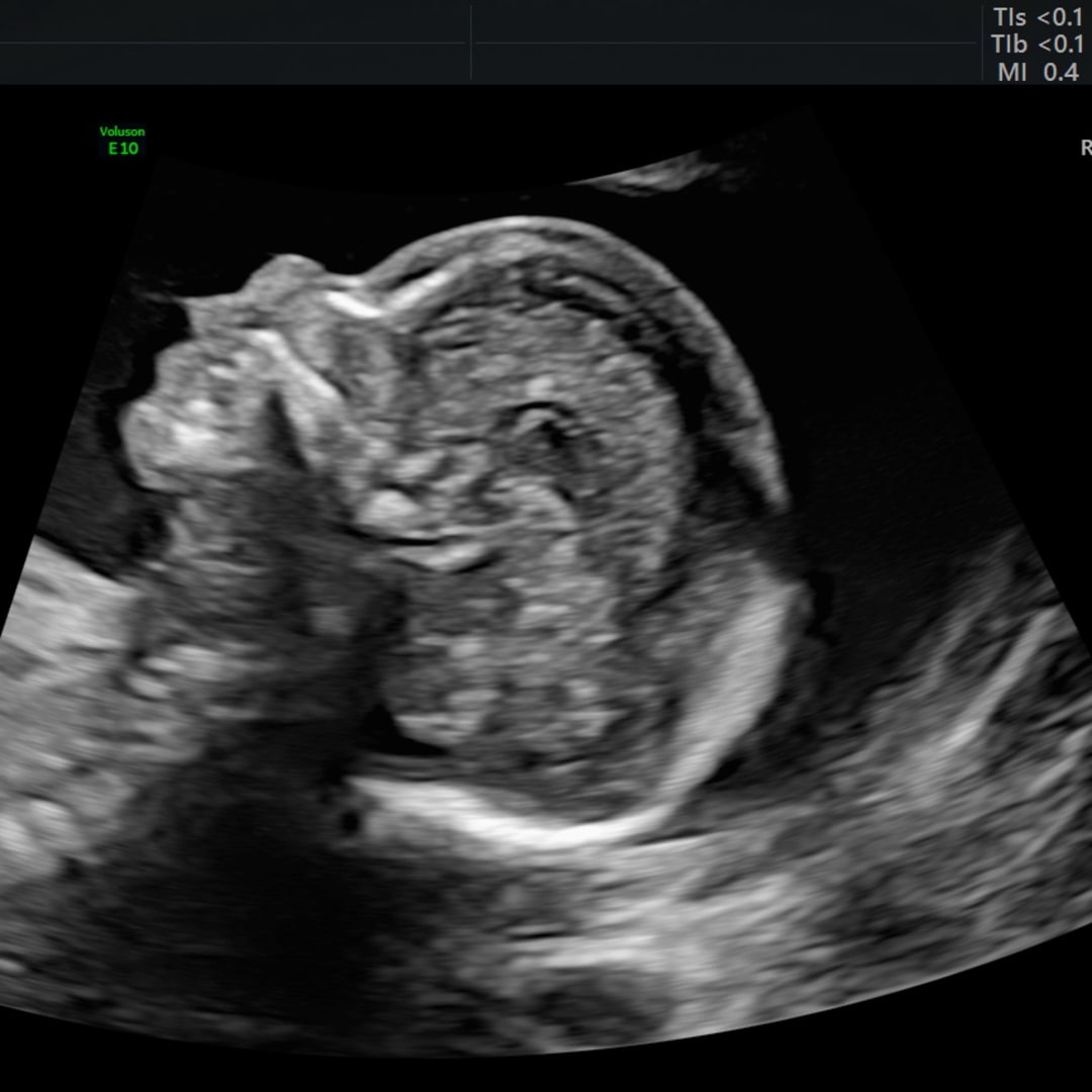Photo shared by Maria for their Babylist baby registry.