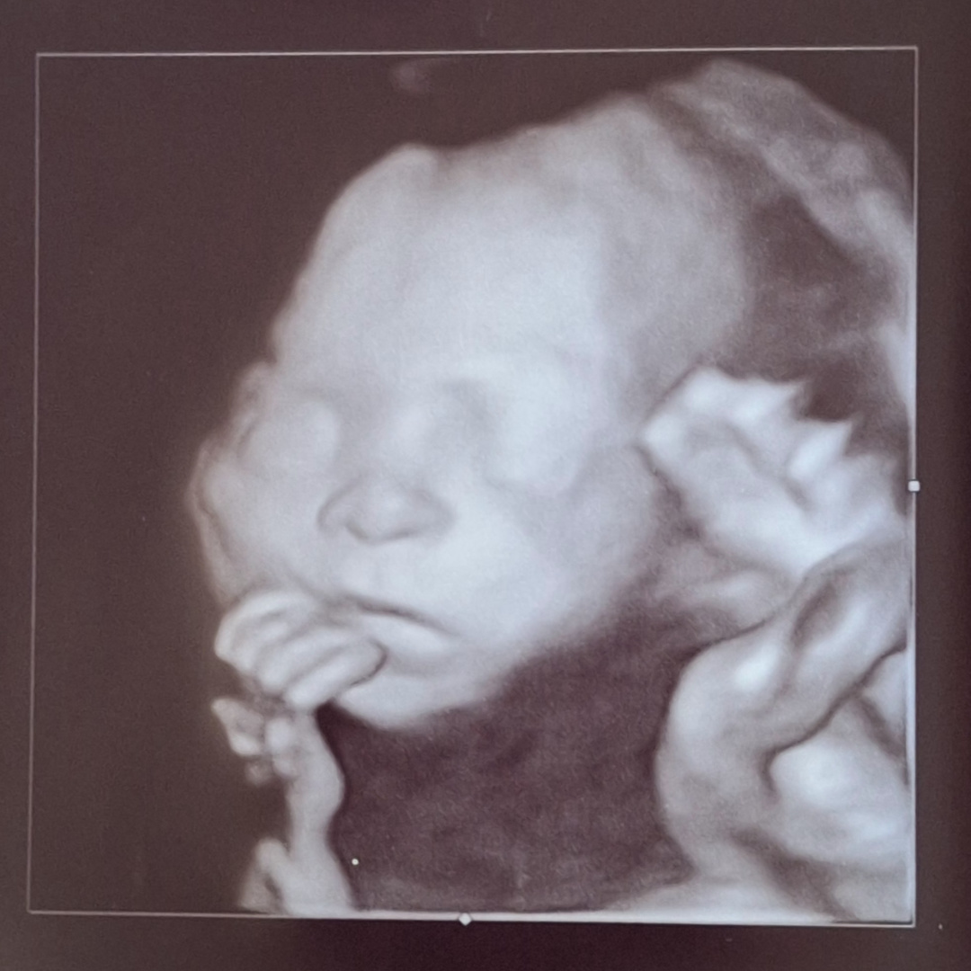 Photo shared by Adrienne for their Babylist baby registry.
