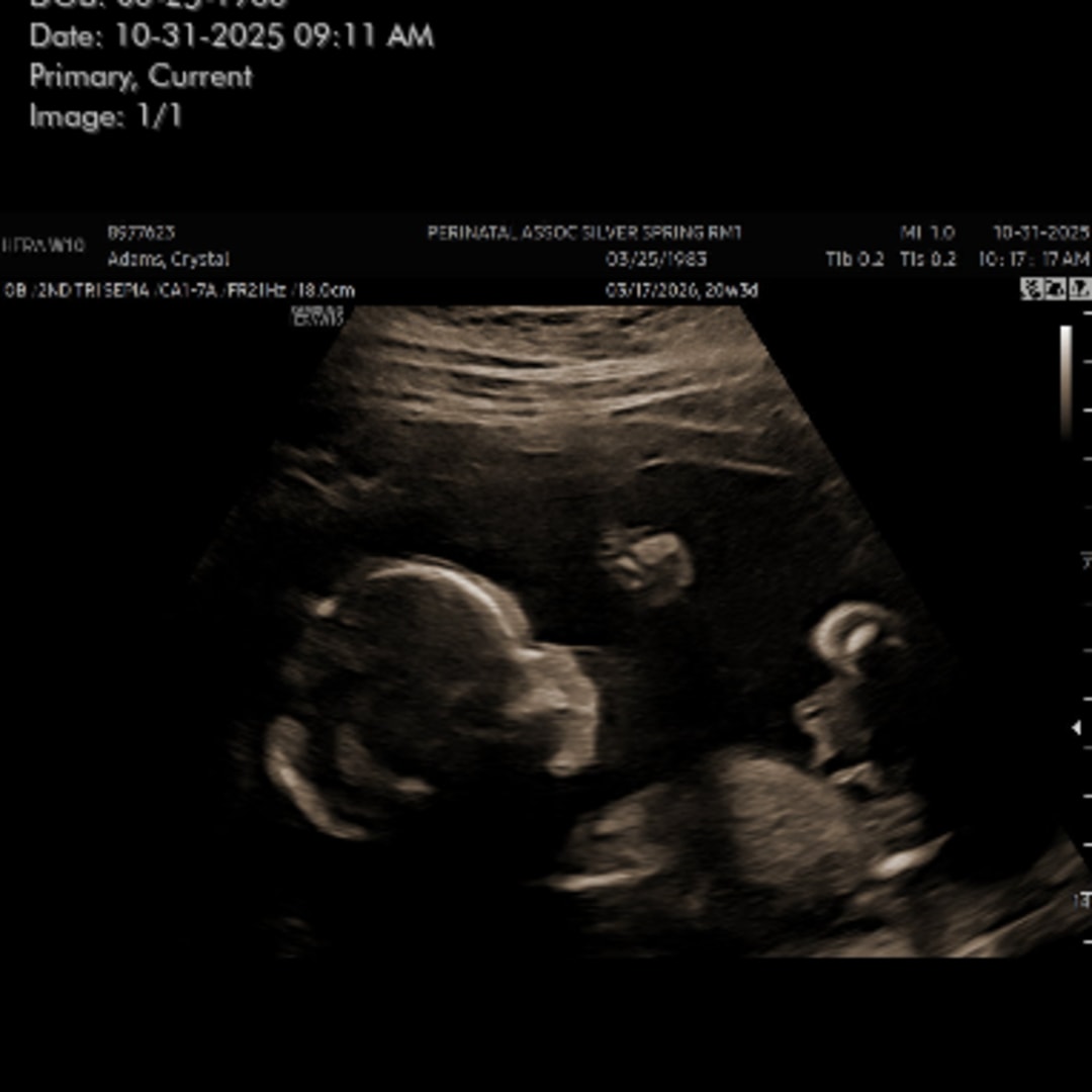 Photo shared by Crystal for their Babylist baby registry.