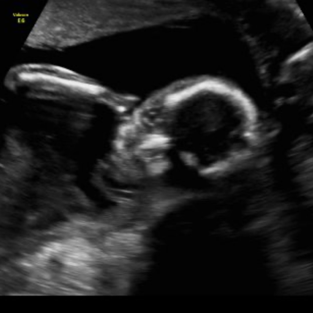 Photo shared by Kaitlyn for their Babylist baby registry.