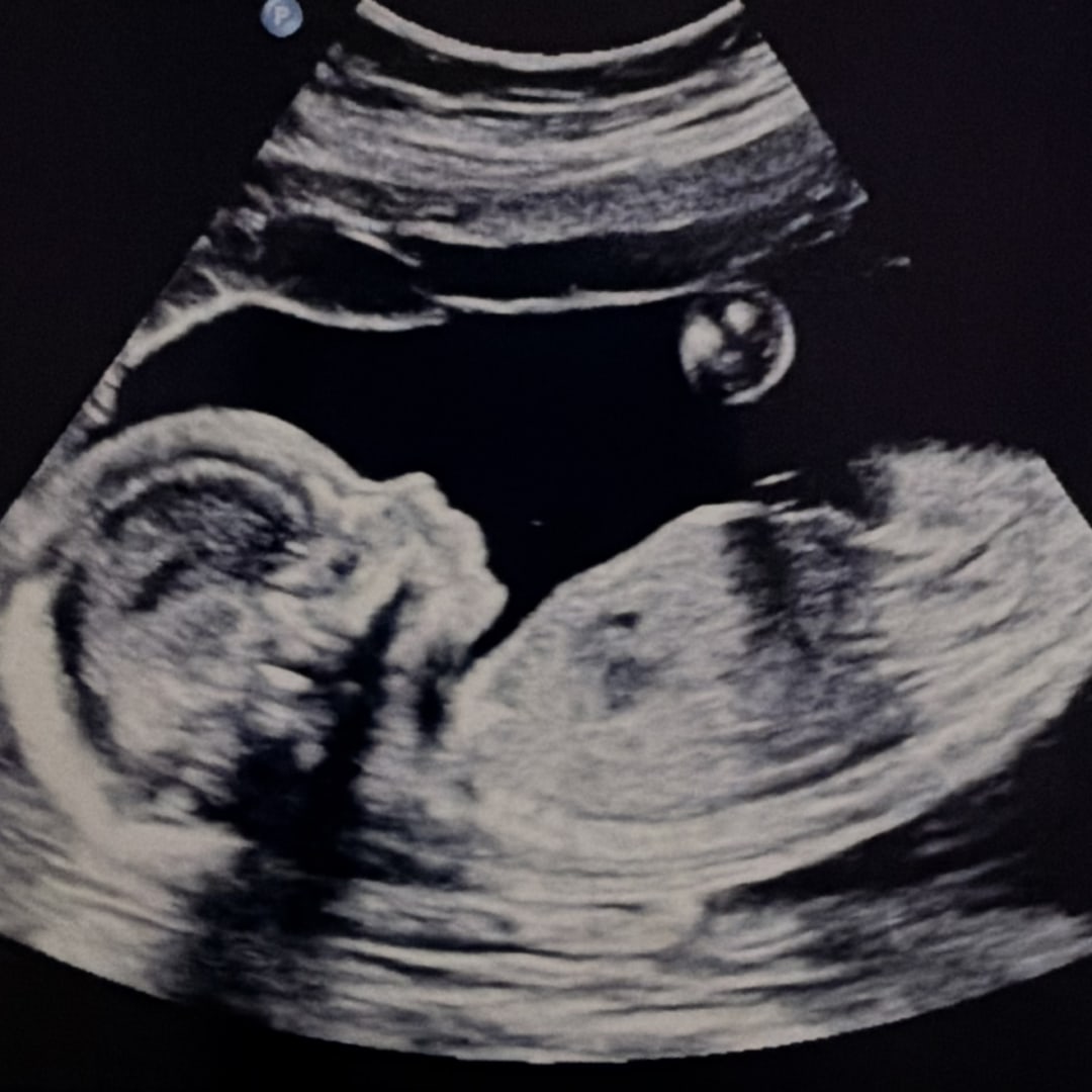 Photo shared by Emilie for their Babylist baby registry.