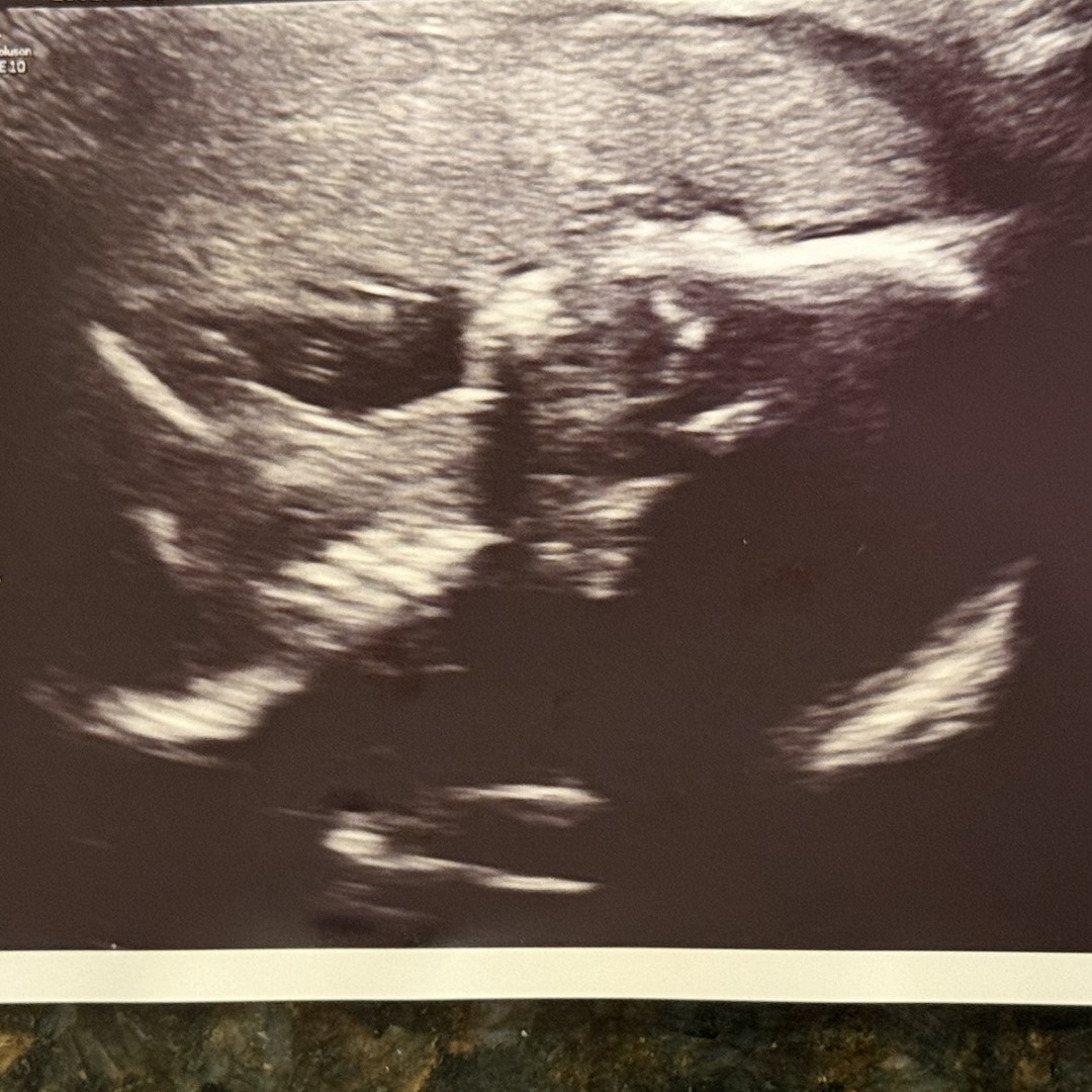 Photo shared by Christian for their Babylist baby registry.