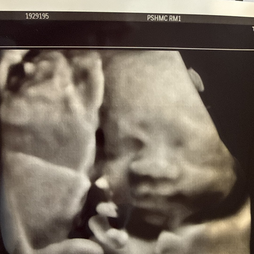 Photo shared by Angelina for their Babylist baby registry.