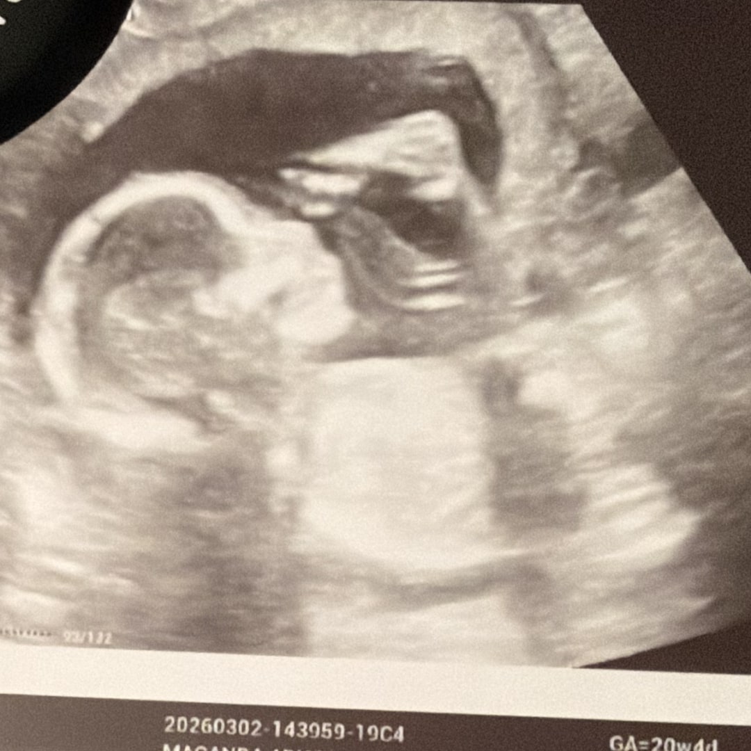 Photo shared by Ari for their Babylist baby registry.