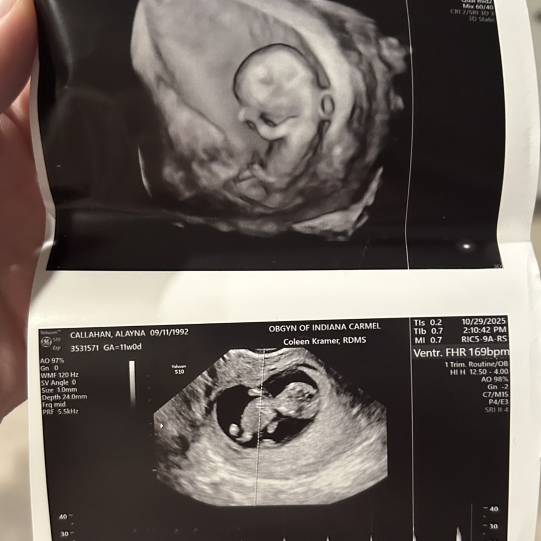 Photo shared by Alayna for their Babylist baby registry.