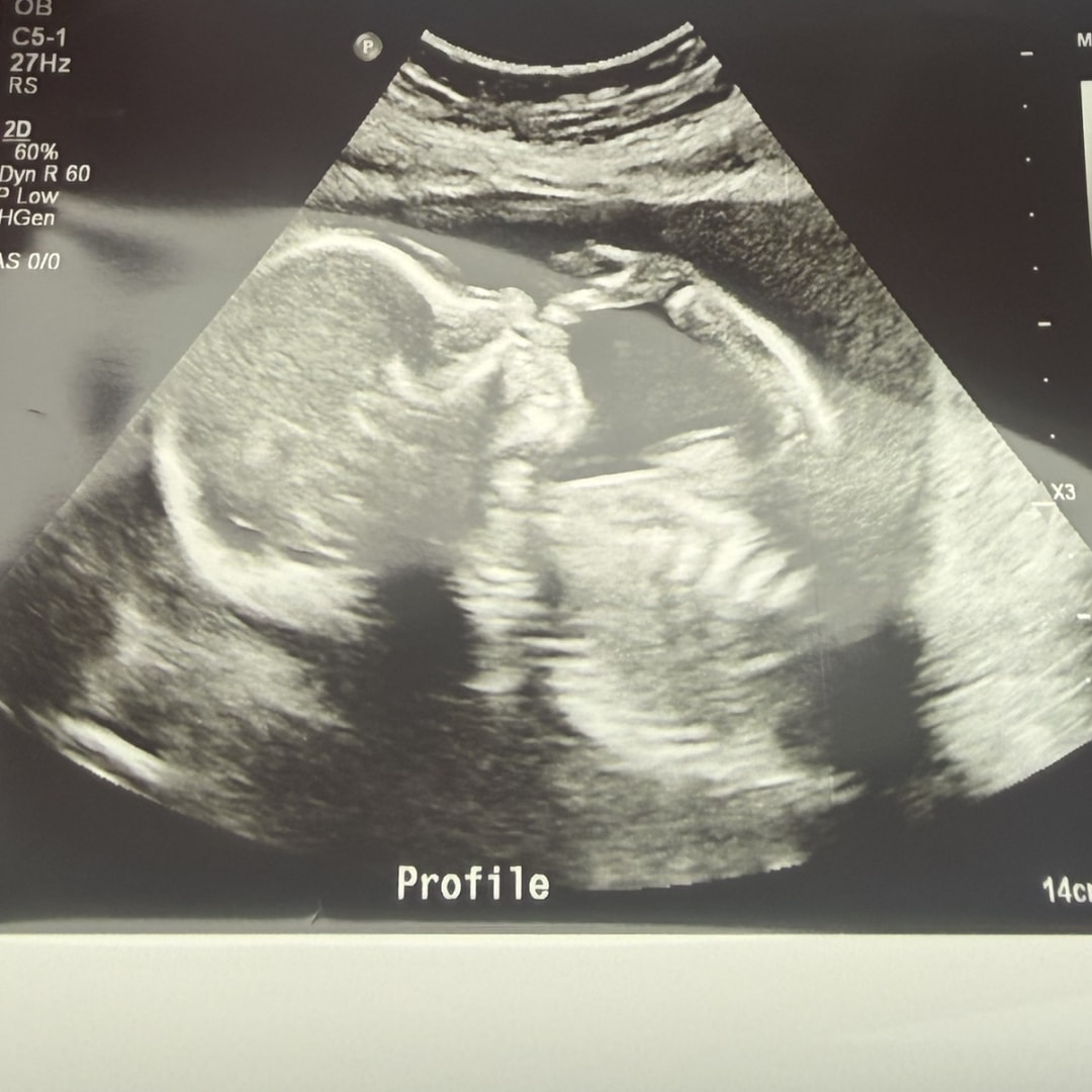 Photo shared by Jessica for their Babylist baby registry.
