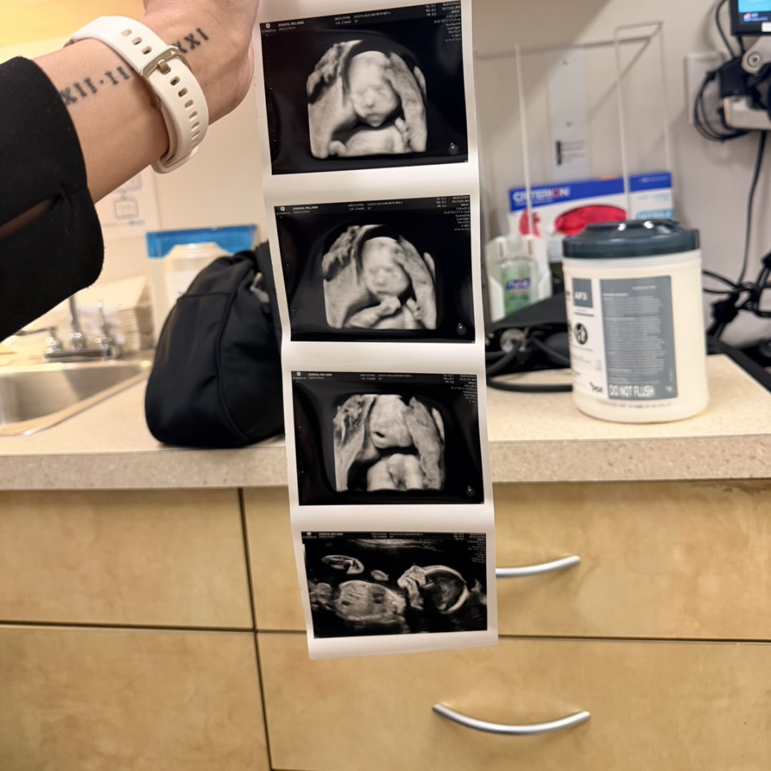 Photo shared by Melanie for their Babylist baby registry.