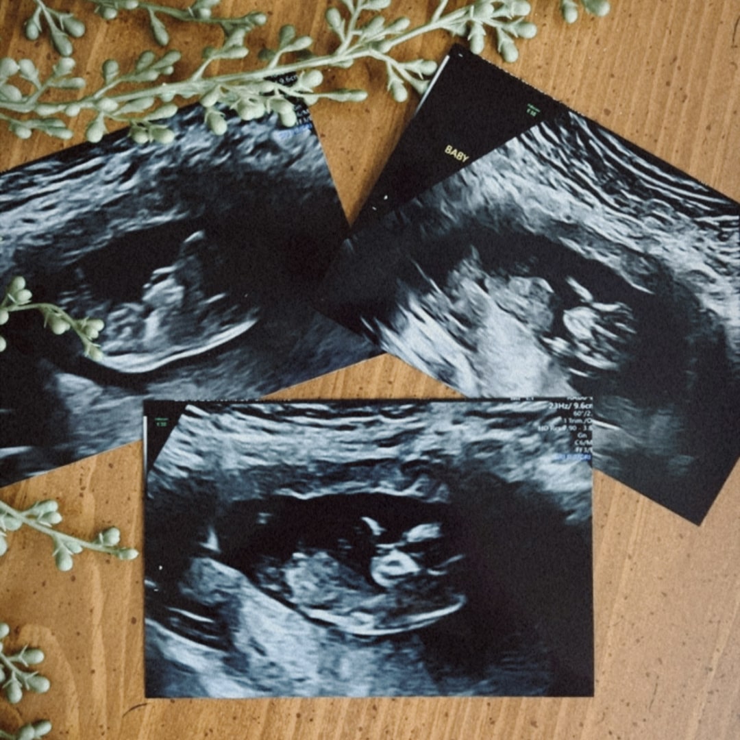 Photo shared by Brandi for their Babylist baby registry.