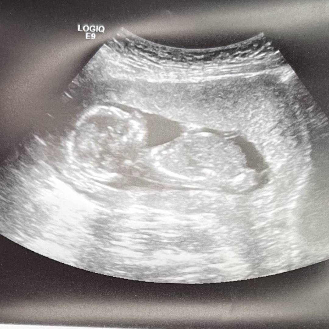 Photo shared by Josie for their Babylist baby registry.