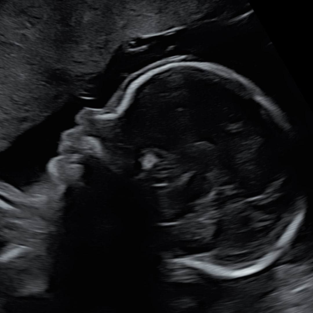 Photo shared by Georgi for their Babylist baby registry.