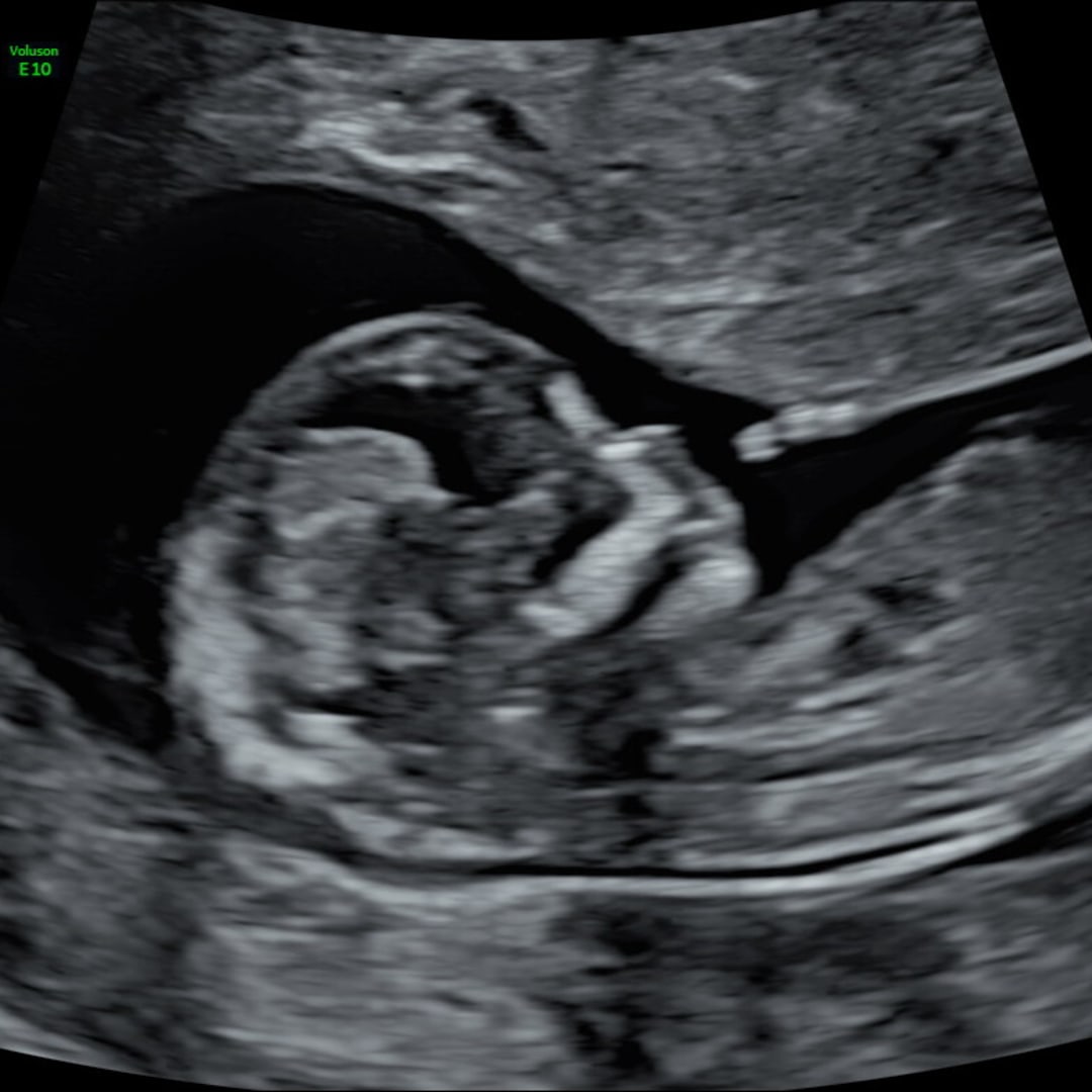Photo shared by Brittany for their Babylist baby registry.