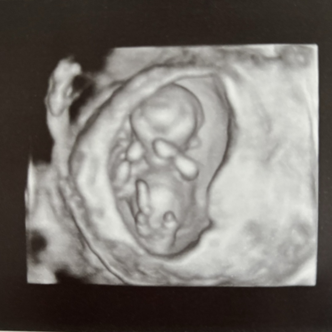 Photo shared by Dannyn for their Babylist baby registry.
