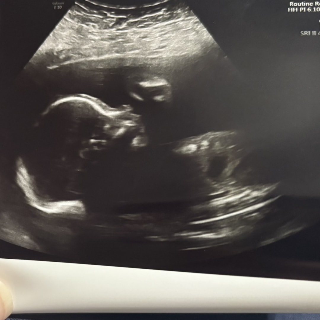 Photo shared by Brittany for their Babylist baby registry.