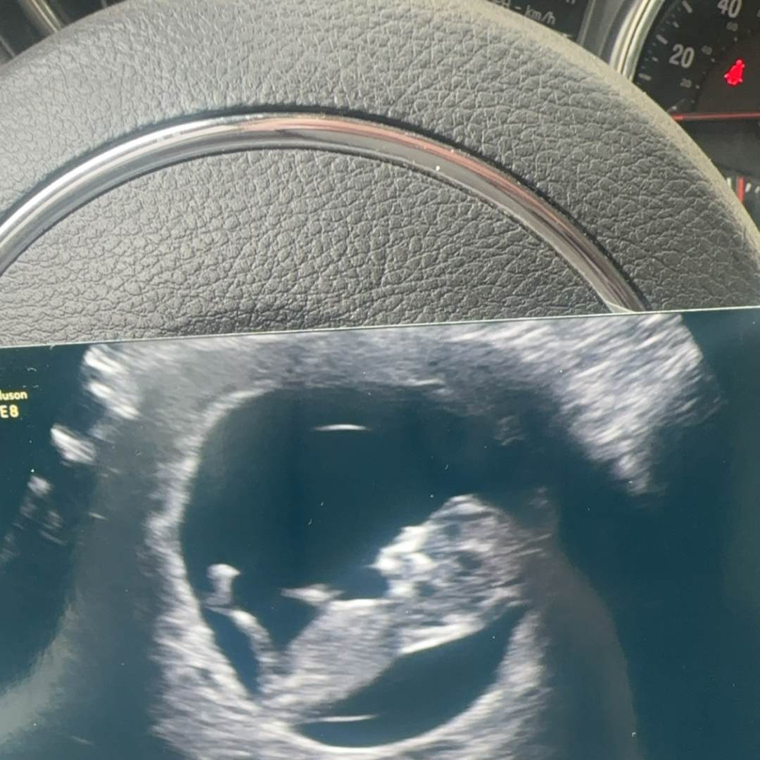 Photo shared by Kortney for their Babylist baby registry.