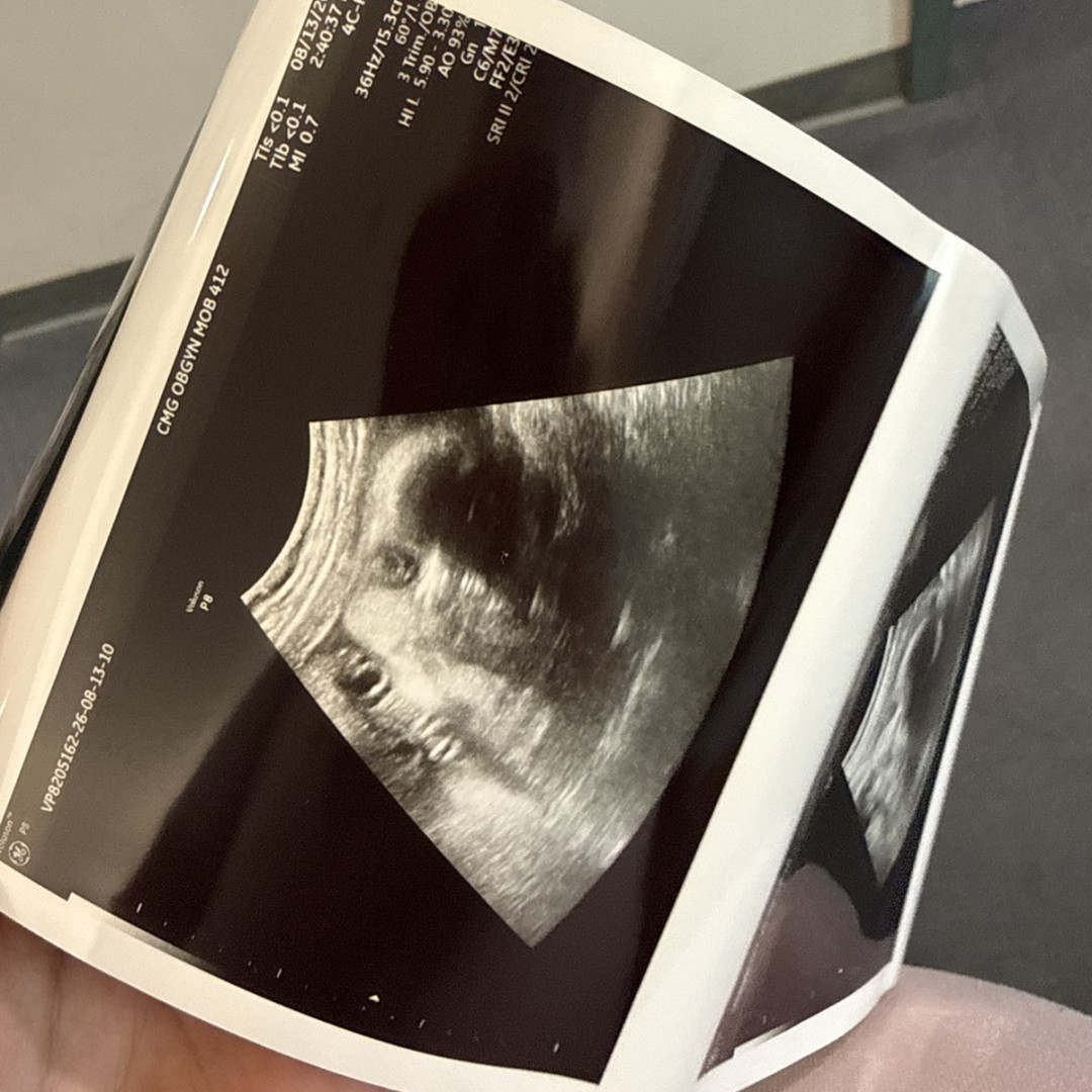 Photo shared by Angela for their Babylist baby registry.