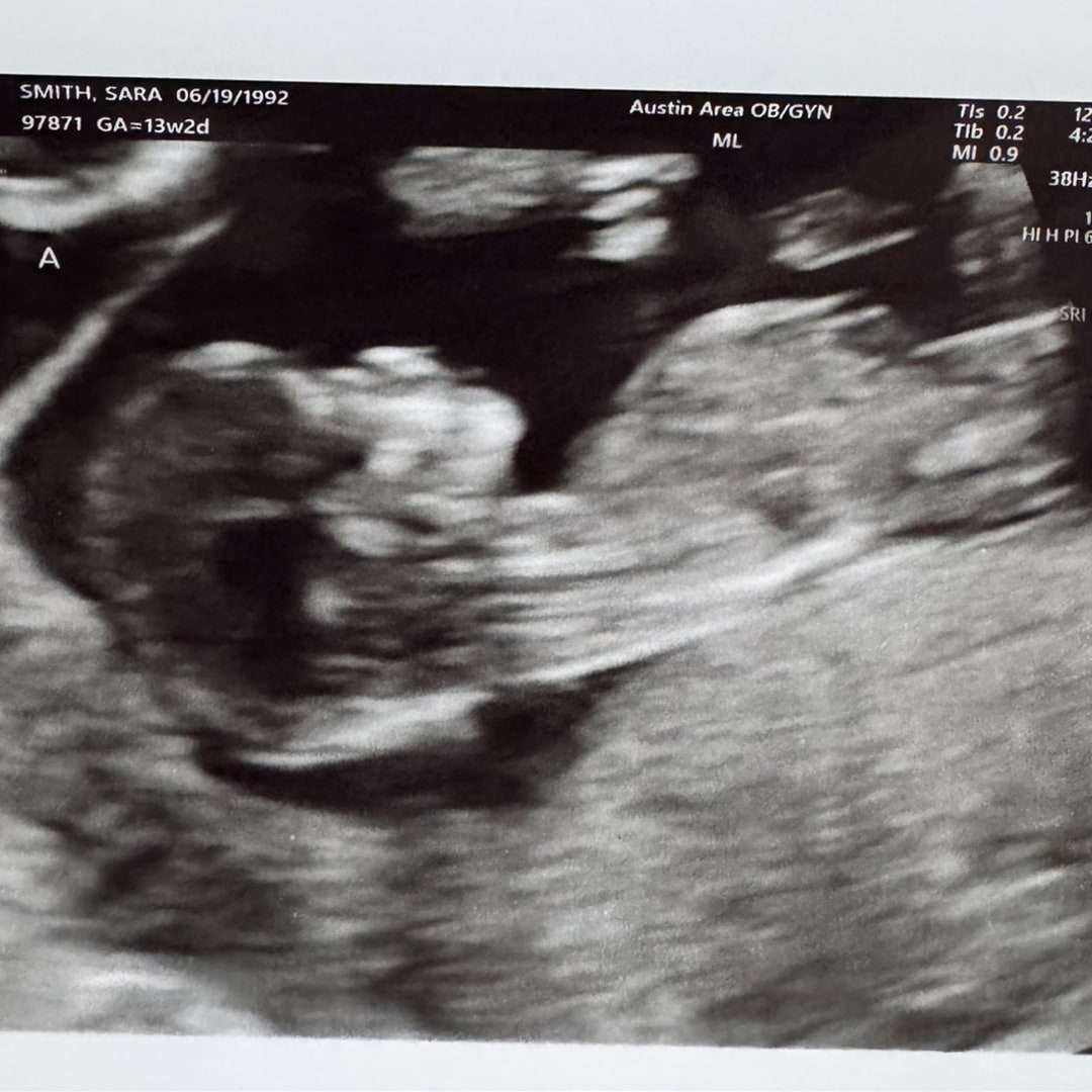 Photo shared by Sarabeth for their Babylist baby registry.