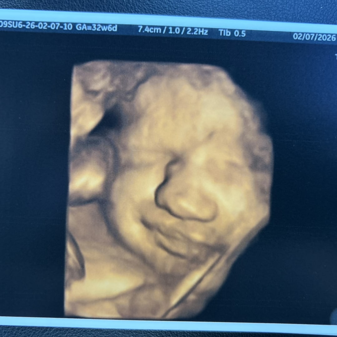 Photo shared by Caitlyn for their Babylist baby registry.