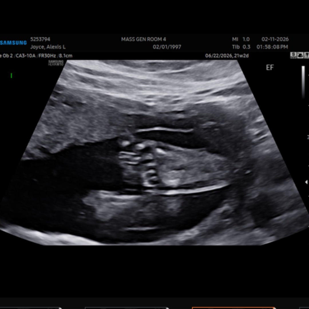 Photo shared by Alexis for their Babylist baby registry.