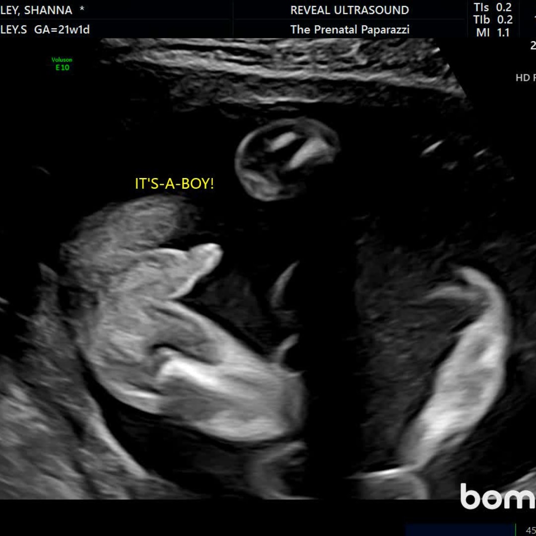 Photo shared by Shanna for their Babylist baby registry.