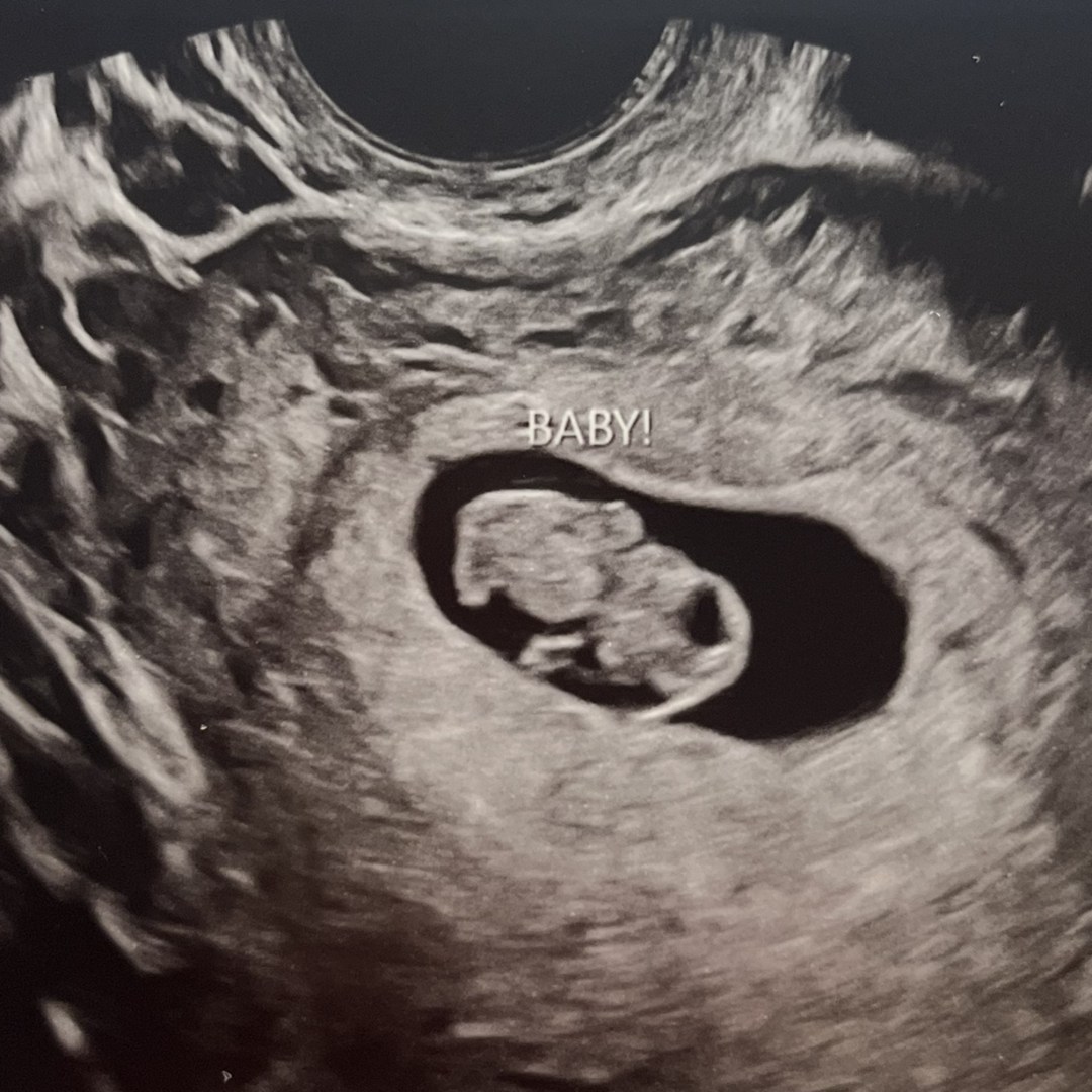 Photo shared by Alaina for their Babylist baby registry.