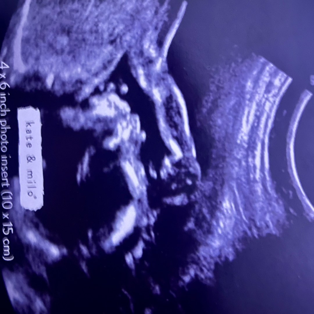 Photo shared by Leticia for their Babylist baby registry.