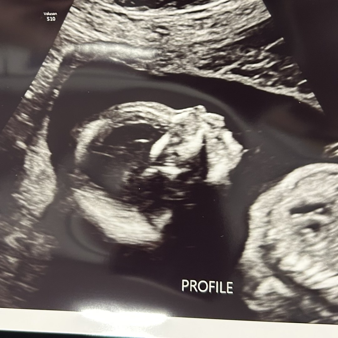 Photo shared by Tara for their Babylist baby registry.