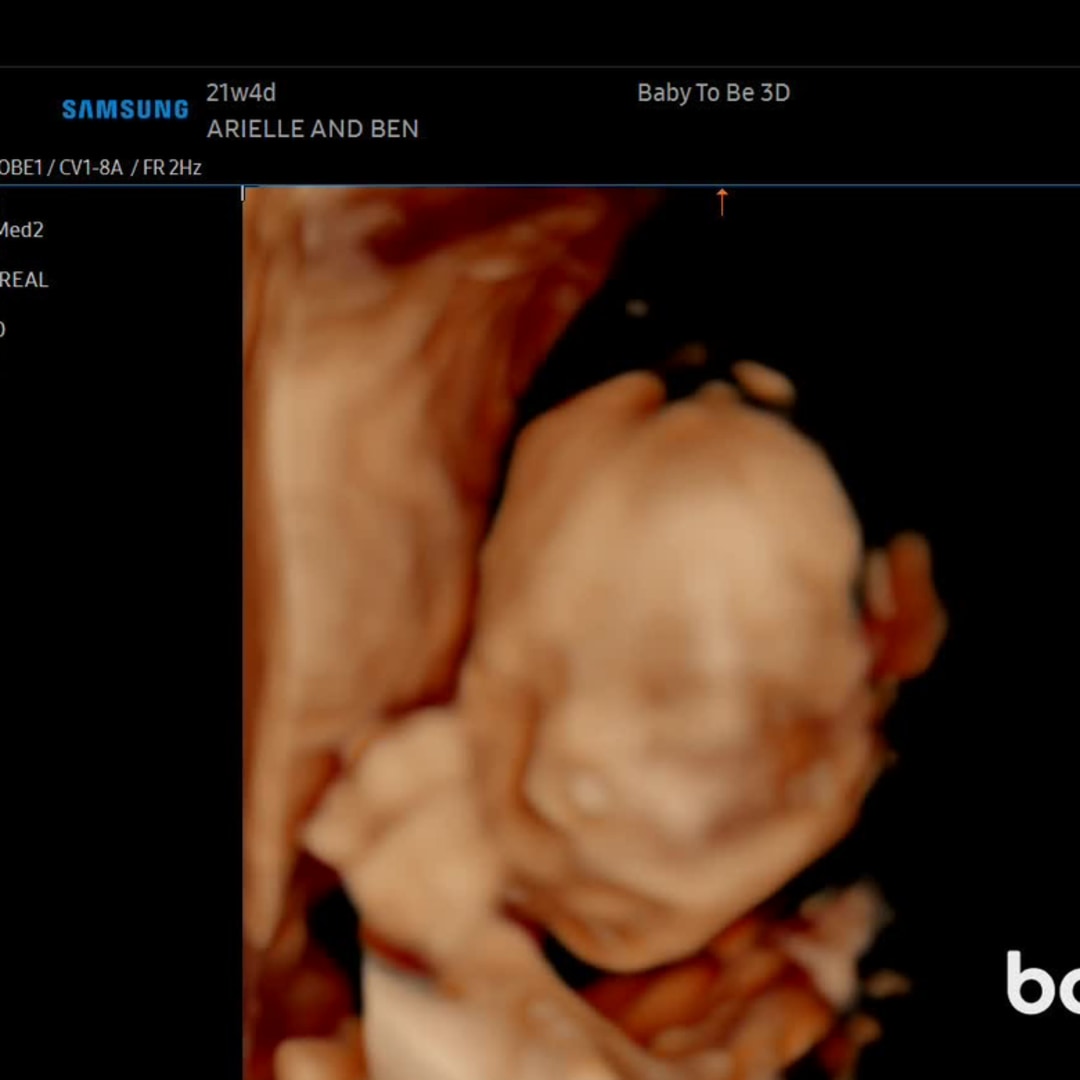 Photo shared by Arielle for their Babylist baby registry.