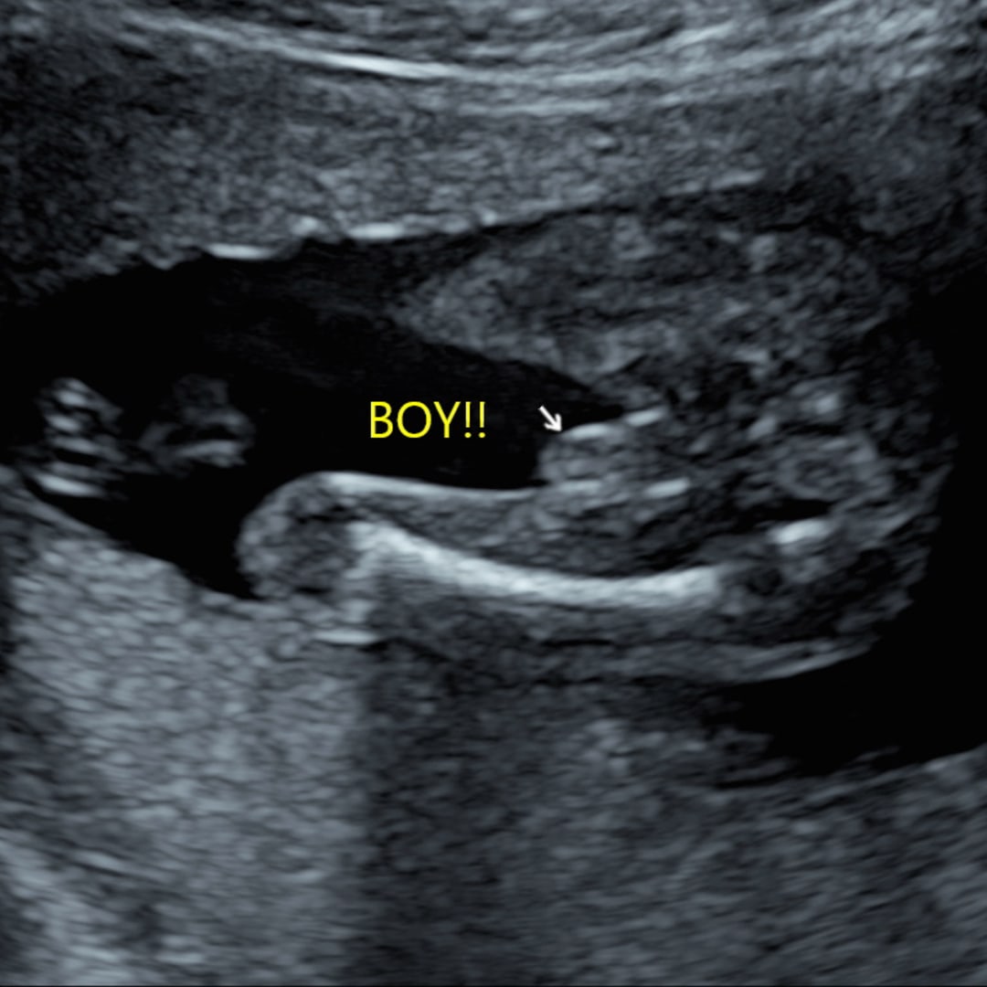 Photo shared by Nikayla for their Babylist baby registry.