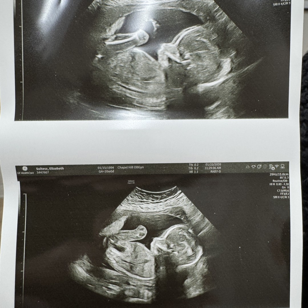 Photo shared by Betsy for their Babylist baby registry.