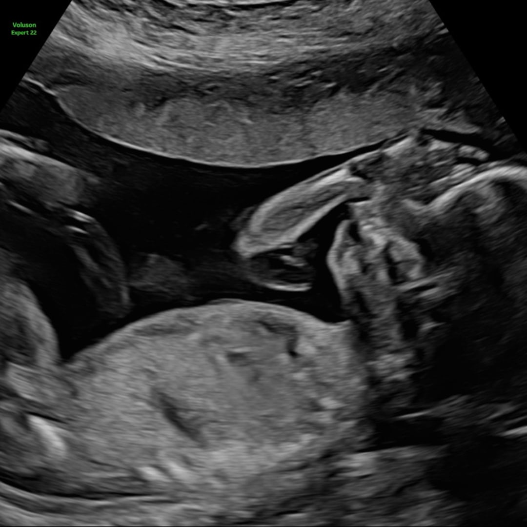 Photo shared by Abby for their Babylist baby registry.