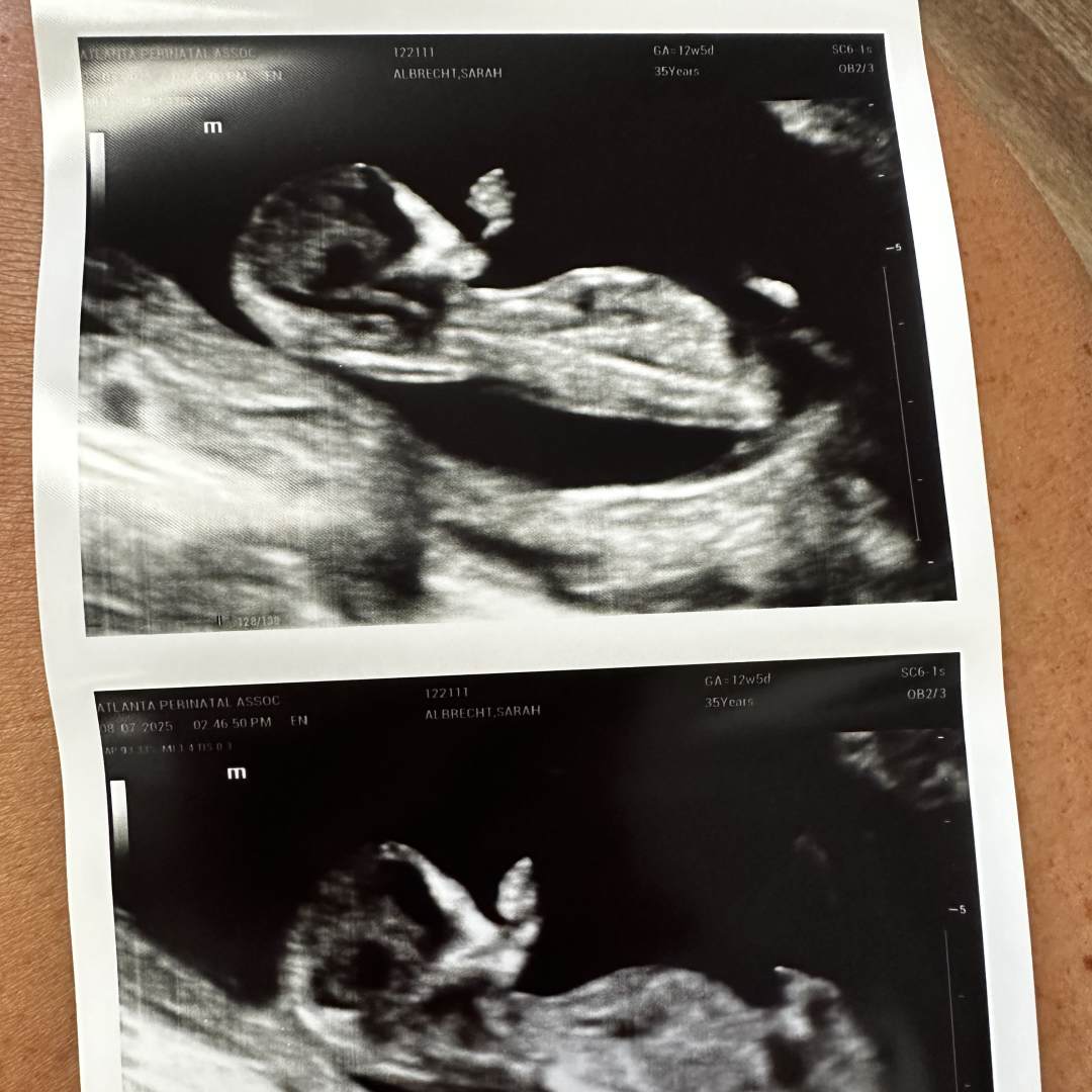 Photo shared by Sarah for their Babylist baby registry.