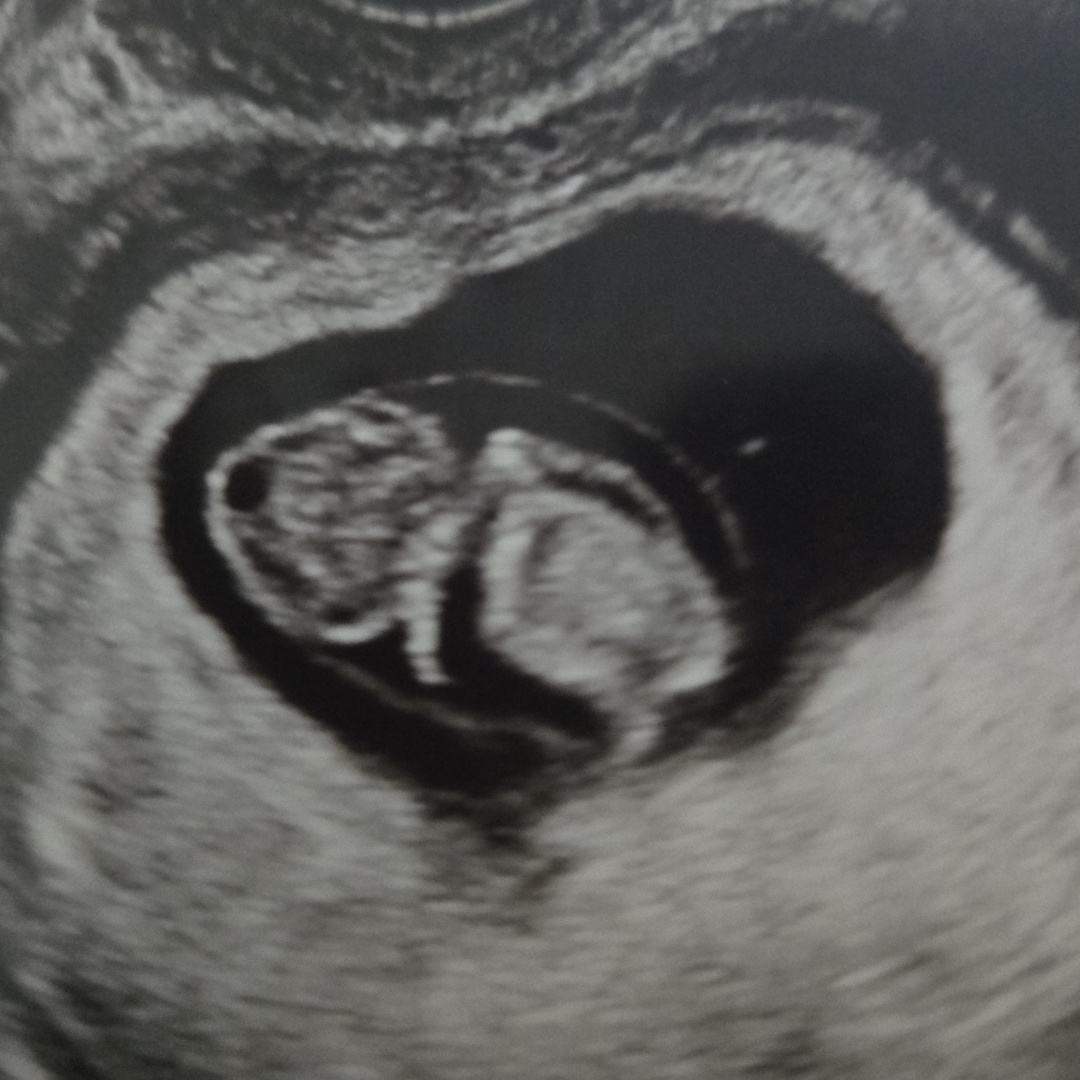 Photo shared by Corey for their Babylist baby registry.